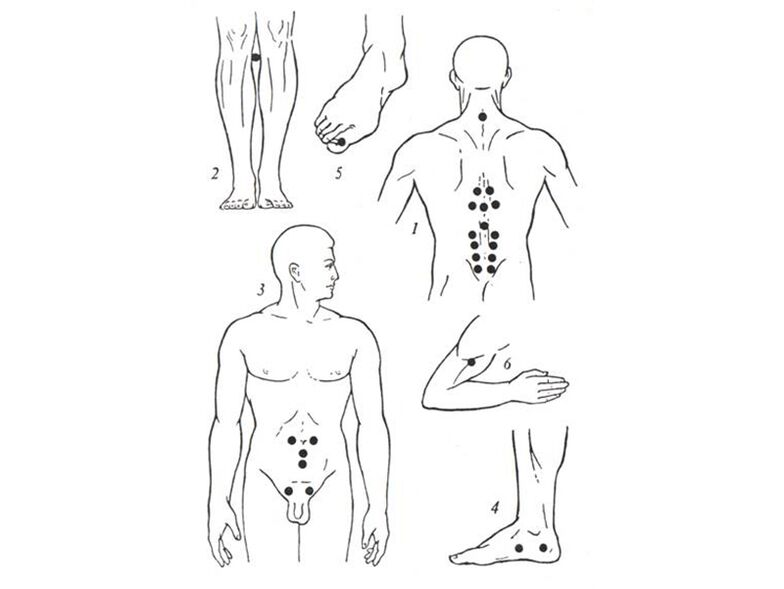 Massage de l'acupuncture